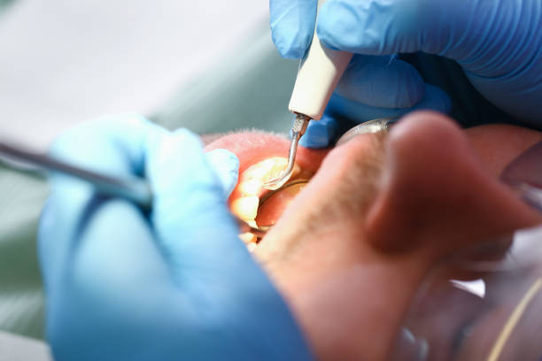 Best Emergency Treatment for Oral Infections in Long Lake, MN