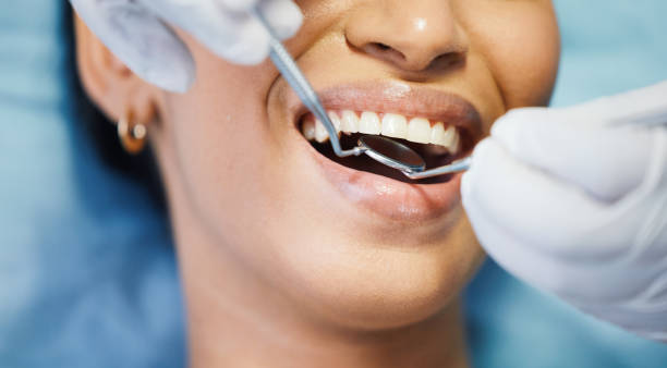 Best Emergency Wisdom Tooth Extraction in Long Lake, MN