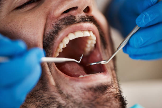 Professional Emergency Dental Service in MN